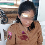 Seorang Pelajar di Pesawaran Tertimpa Baliho Ukuran Jumbo Bergambar Calon Bupati Nanda- Antonius